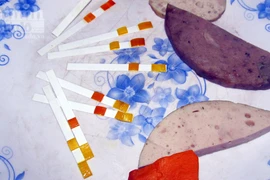 Tạm giữ hàng chục kilogam giò - chả nghi vấn có hàn the