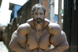 Nghiện tiêm dầu để có bắp tay khủng như người khổng lồ xanh 