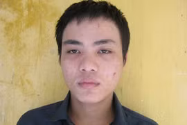 Khống chế người tình vào khách sạn để hiếp – cướp trước mặt nhiều người