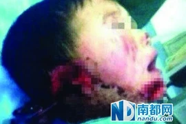 Trung Quốc: Một bé trai bị hành hung