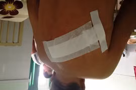 Cựu chiến binh bị côn đồ xông vào nhà chém gục