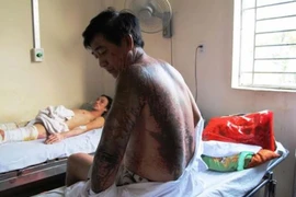 Vô cớ bị tạt a xít lúc đi tập thể dục lúc rạng sáng