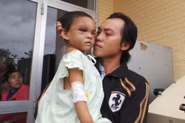 Cha ruột bé 4 tuổi bị bạo hành ở Bình Dương đến nhận con