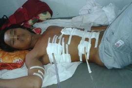 Bị đâm nguy kịch vì ném dép trúng đầu bạn