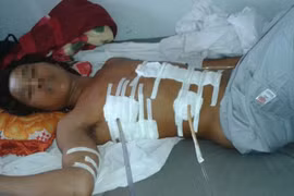 Bị đâm nguy kịch vì ném dép trúng đầu bạn