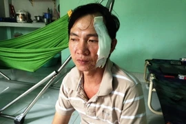 Liều lĩnh gọi cửa, dí dao dọa cắt cổ cướp tài sản