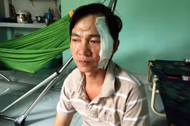 Liều lĩnh gọi cửa, dí dao dọa cắt cổ cướp tài sản