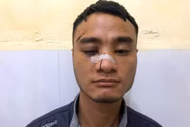 Ngựa quen đường cũ