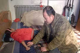 Con gái suýt chết vì cha dại dột cho rắn độc cắn tay để trị bệnh