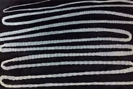 Sán dây 6,2m làm tổ trong dạ dày của người đàn ông thích ăn thịt bò tái