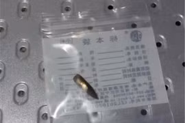 Bị trúng đạn lạc vì trường bắn gần khu dân cư