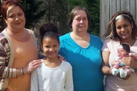 Bé gái có tóc bạc từ lúc mới sinh