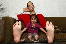 Cuộc gặp gỡ thú vị của người có bàn chân lớn và nhỏ nhất thế giới