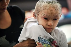 Đáng thương cậu bé người cá ở Trung Quốc