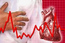 Kháng sinh Zithromax có thể ảnh hưởng đến nhịp tim