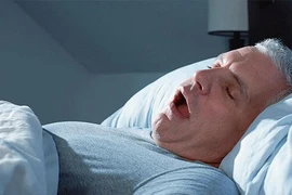 Ngáy có gây đau tim?