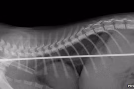 Chú mèo sống sót kỳ diệu sau khi ăn…ăng-ten ti-vi