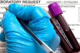 Ung thư vòm họng gia tăng đột biến do... "yêu" bằng miệng