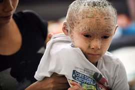 Đáng thương cậu bé người cá ở Trung Quốc