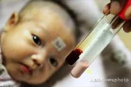 Nồng độ vitamin D thấp và nguy cơ thiếu máu ở trẻ