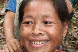 Răng càng nhọn, càng được coi là phụ nữ đẹp