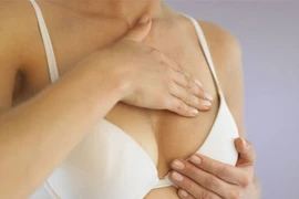 5 cách giảm nguy cơ ung thư vú