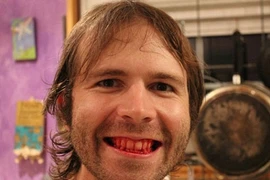 Người đàn ông nghiện ăn thịt sống