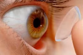 Cô gái 18 tuổi suýt bị mù mắt vì kính áp tròng