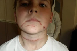 Suýt đứt đầu vì một trò đùa vô hại