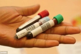 Lạc quan giúp giảm lượng cholesterol 