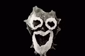 Amip ăn não - mắc bệnh là coi như... xong!