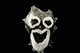 Amip ăn não - mắc bệnh là coi như... xong!