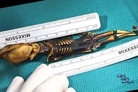 Bộ xương giống người ngoài hành tinh tiết lộ nhiều bí ẩn y học