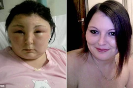 Tự nhuộm tóc khiến mắt bị mù và mặt bị biến dạng hoàn toàn