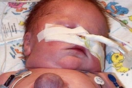 Ca đầu tiên trên thế giới sống sót với quả tim ngoài lồng ngực