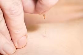 Thụy Sĩ: 16 người nhiễm HIV vì châm cứu