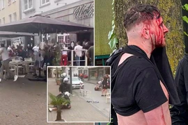 Vướng vào ẩu đả ở EURO 2024, CĐV Anh bị đánh vỡ đầu