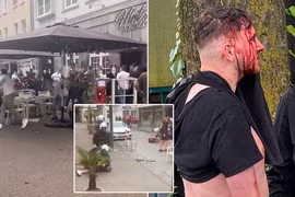 Vướng vào ẩu đả ở EURO 2024, CĐV Anh bị đánh vỡ đầu