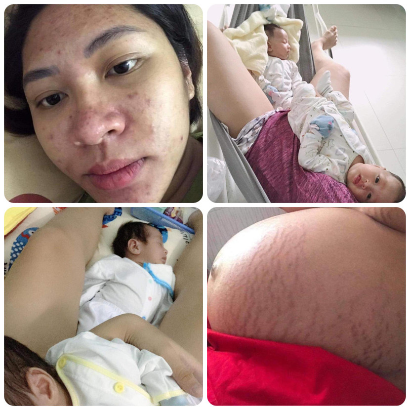 Hoa hậu Đặng Thu Thảo không ngần ngại chia sẻ hình ảnh xuống sắc khi mang song thai Hoa hậu Đặng Thu Thảo không ngần ngại chia sẻ hình ảnh xuống sắc khi mang song thai