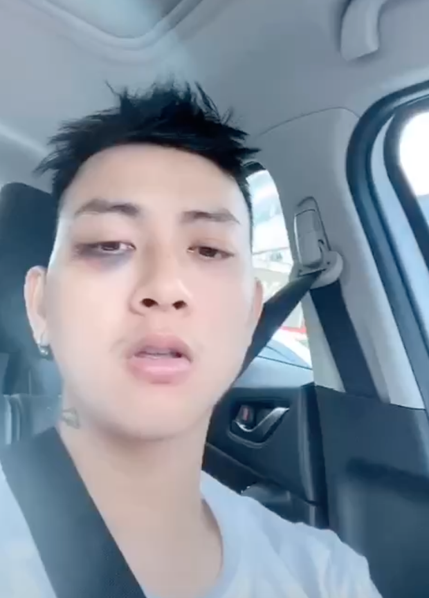 Hình ảnh trích ra từ đoạn clip ghi Hoài Lâm với khuôn mặt phờ phạc, một bên mắt bầm tím và có những biểu cảm cực kỳ khó hiểu