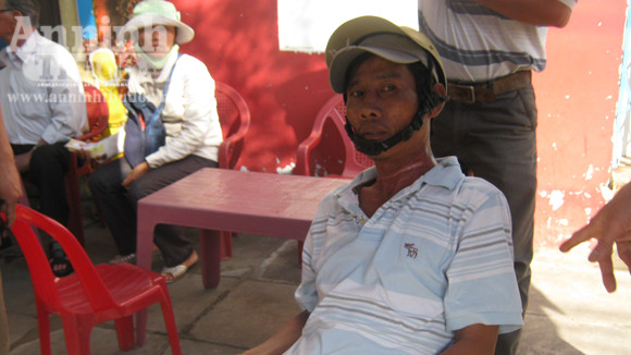 Dây sà xuống đường, cứa cổ người đi đường ảnh 1