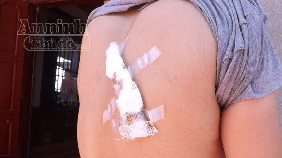 Nữ sinh bị người yêu cũ “bắt cóc” sau ngày thi tốt nghiệp đầu tiên ảnh 2