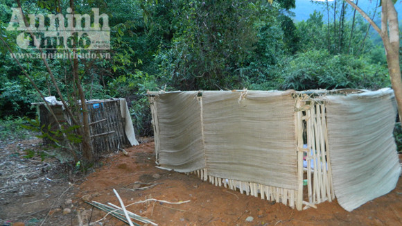 Thêm một cháu bé tử vong vì mắc bệnh lạ ảnh 1