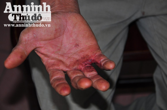 Ông xe ôm "lục tuần" bẻ gãy dao nhọn của tên cướp ảnh 2