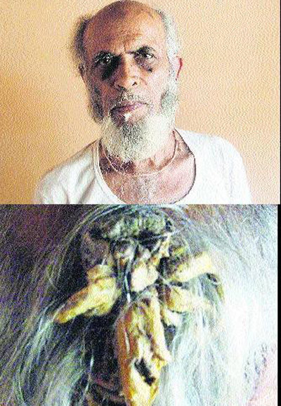 "Bí ẩn" những chiếc sừng mọc trên...đầu người ảnh 5