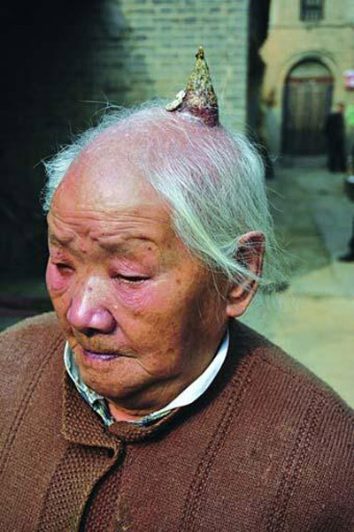 "Bí ẩn" những chiếc sừng mọc trên...đầu người ảnh 2