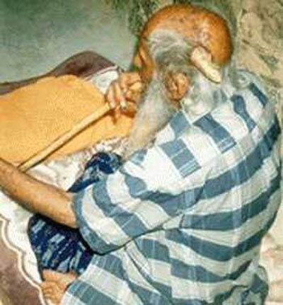 "Bí ẩn" những chiếc sừng mọc trên...đầu người ảnh 4