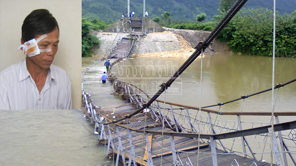 Đắk Lắk: Sập cầu treo, một người dân bị thương ảnh 1