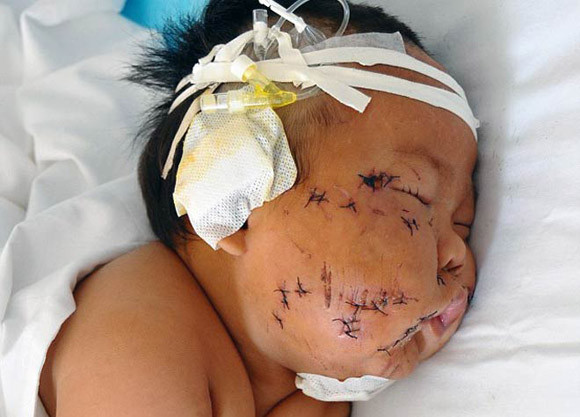 Bị con cắn khi cho bú, mẹ dã tâm đâm liên tiếp vào mặt con ảnh 1