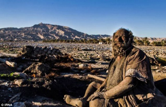 Người đàn ông bẩn nhất thế giới - 60 năm không tắm ảnh 2